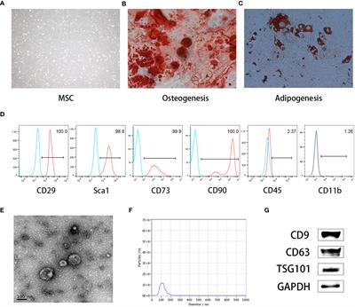 Mesenchymal stem cell-derived exosomes can alleviate GVHD and preserve the GVL effect in allogeneic stem cell transplantation animal models